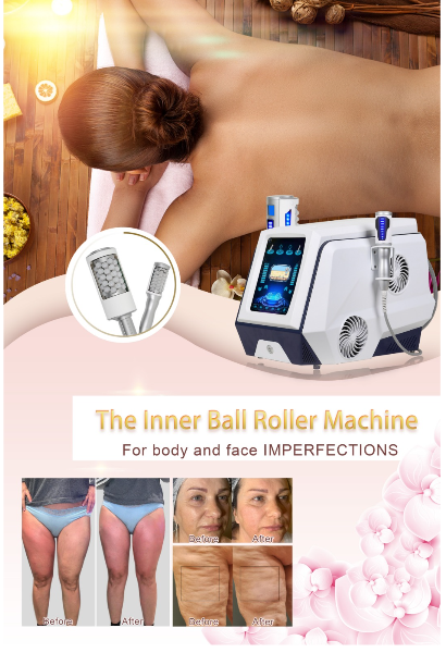 Endo Esferas 360  Com  6 Rolos Facial e Corporal